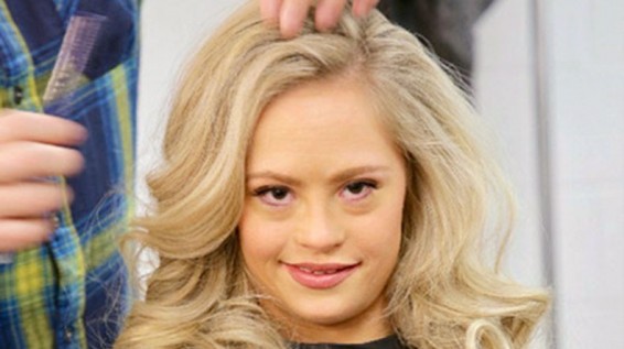 Դաունի համախտանիշով աղջիկը գեղեցկության մրցույթի հաղթող