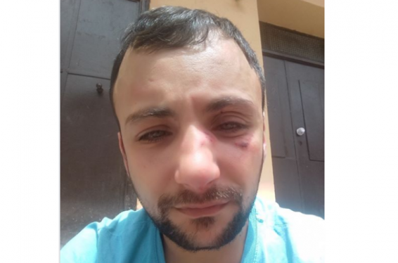 ՀԱԿ ակտիվիստ Վարդան Հարությունյանի հետ կապված միջադեպով ոստիկանությունում հարուցվել է քրեական գործ