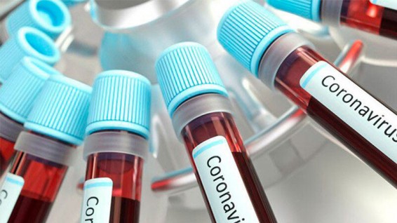 В ближайшие дни армянские тесты против COVID появятся в больницах