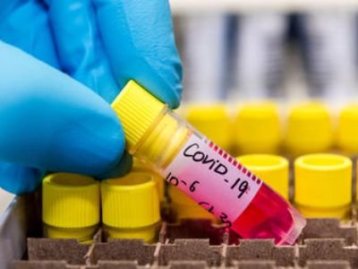 В Армении за сутки зарегистрировано 838 новых случаев заражения коронавирусом