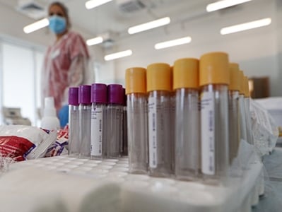 За сутки зарегистрировано 93 новых случая заражения коронавирусом