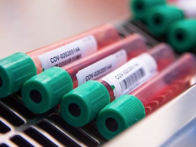 В Армении за сутки зарегистрировано 1217 новых случаев заражения коронавирусом
