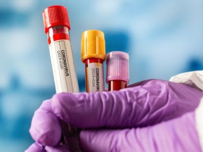 В Армении за сутки зарегистрировано 2603 новых случая заражения коронавирусом