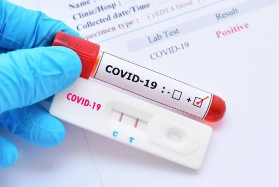 В Арцахе подтверждено 42 новых случая заражения COVID-19