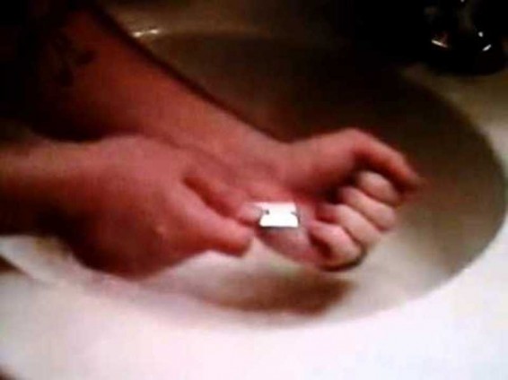 Էքստրասենսի սպանության մեջ մեղադրվողը կարել է աչքերը եւ կտրել երակները