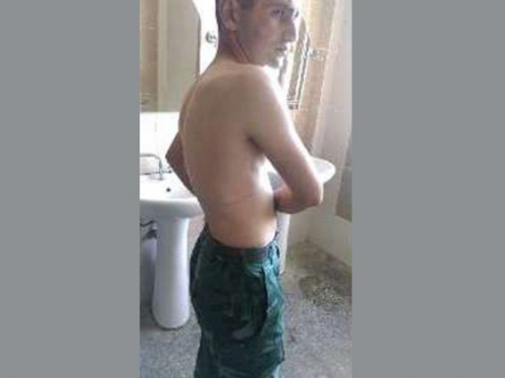 Ադրբեջանում ոստիկանները կտտանքների են ենթարկել զինծառայողին