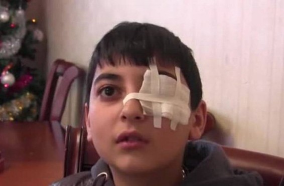 Աշակերտի աչքը վնասած ուսուցչից նյութական վնասի փոխհատուցում է պահանջվում. ՀՔԱՎ